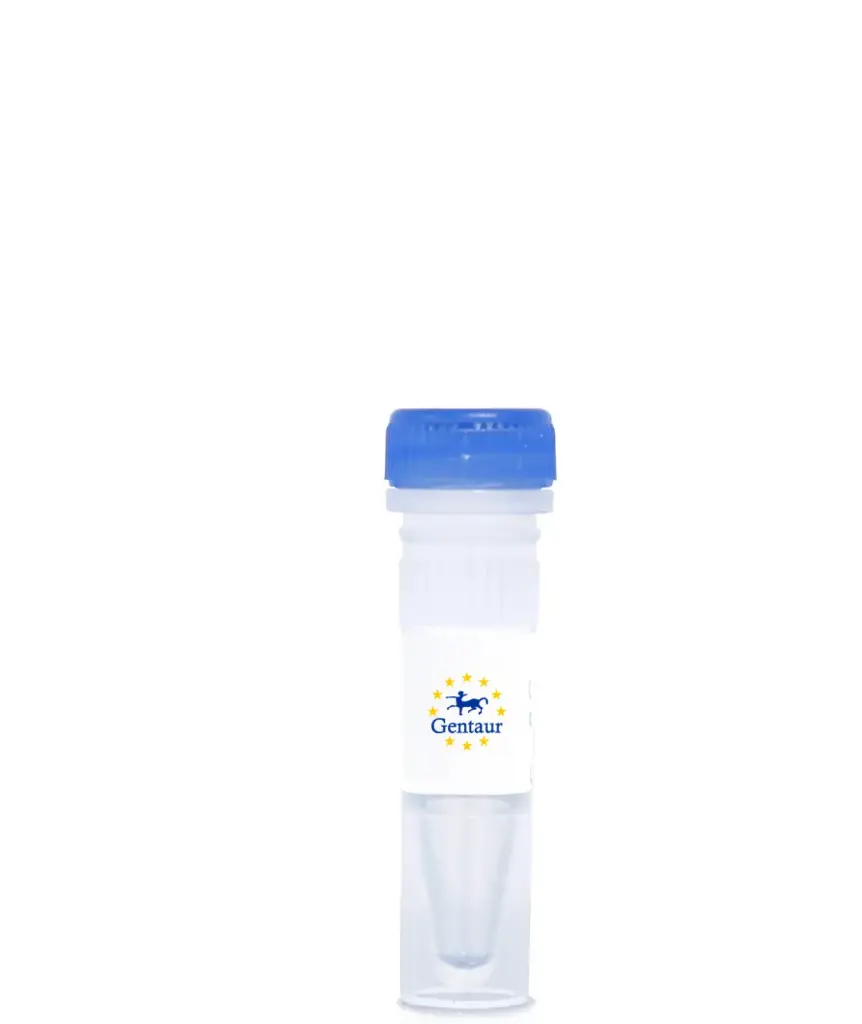 Human Chikungunya IgM Capture ELISA Kit